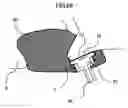 Fig. 69 - Organism information detection device and sphygmomanometer