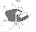 Fig. 72 - Organism information detection device and sphygmomanometer