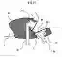 Fig. 77 - Organism information detection device and sphygmomanometer
