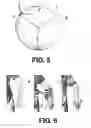 Fig. 05 - BLOOD PRESSURE CUFF WITH CYLINDRICAL BLADDER