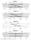Fig. 02 - Composite guidewire