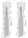 Fig. 07 - Composite guidewire