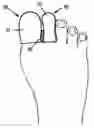 Fig. 01 - Toe glove device
