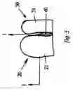 Fig. 04 - Toe glove device