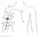 Fig. 01 - Medical devices