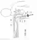 Fig. 12 - Medical devices