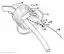 Fig. 01 - Mouthguard having device securing tab