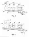 Fig. 04 - Replaceable supplies for IV fluid delivery systems
