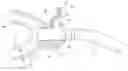 Fig. 01 - Endoscopic device stabilizer