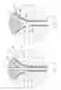 Fig. 44 - Fluid delivery devices, systems and methods