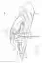 Fig. 49 - Fluid delivery devices, systems and methods