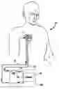 Fig. 01 - Implantable dialysis access port
