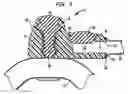 Fig. 05 - Implantable dialysis access port
