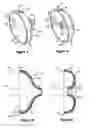 Fig. 07 - Method and apparatus for applying medication to internal tissue