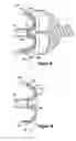 Fig. 08 - Method and apparatus for applying medication to internal tissue