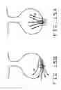 Fig. 20 - Method for safely and efficiently navigating magnetic devices in the body