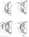 Fig. 02 - Device and method for reshaping the cornea