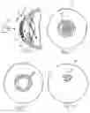 Fig. 07 - Device and method for reshaping the cornea
