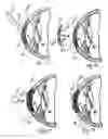 Fig. 08 - Device and method for reshaping the cornea