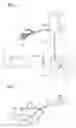Fig. 05 - Treatment tool for endoscope