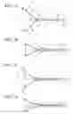 Fig. 07 - Treatment tool for endoscope