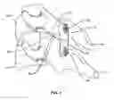 Fig. 02 - Facet spacer