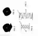 Fig. 03 - Aligning device for stent graft delivery system