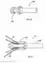 Fig. 10 - Aligning device for stent graft delivery system