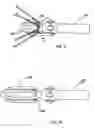 Fig. 11 - Aligning device for stent graft delivery system