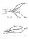 Fig. 02 - Releasable basket and method of making thereof
