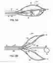 Fig. 08 - Releasable basket and method of making thereof