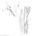 Fig. 02 - Apparatus and method for positive closure of an internal tissue membrane opening