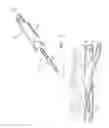 Fig. 04 - Apparatus and method for positive closure of an internal tissue membrane opening
