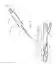 Fig. 05 - Apparatus and method for positive closure of an internal tissue membrane opening