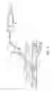 Fig. 09 - Apparatus and method for positive closure of an internal tissue membrane opening