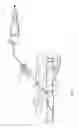 Fig. 12 - Apparatus and method for positive closure of an internal tissue membrane opening