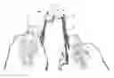 Fig. 01 - Suture needle retention device