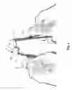Fig. 07 - Suture needle retention device