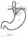 Fig. 02 - Methods and devices for anchoring to tissue