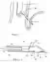 Fig. 03 - Methods and devices for anchoring to tissue