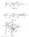 Fig. 05 - Methods and devices for anchoring to tissue