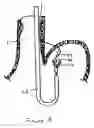 Fig. 06 - Methods and devices for anchoring to tissue