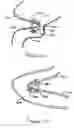 Fig. 09 - Methods and devices for anchoring to tissue