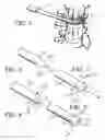 Fig. 04 - Method and apparatus to penetrate soft tissue and produce passageway in hard tissue while protecting principal vasculature and nerves