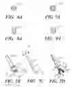 Fig. 05 - Method and apparatus to penetrate soft tissue and produce passageway in hard tissue while protecting principal vasculature and nerves