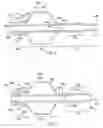 Fig. 04 - Flexible tip