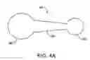 Fig. 05 - Pyloric valve corking device