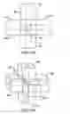 Fig. 13 - Pyloric valve corking device