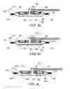 Fig. 04 - Low-cost disposable tourniquet cuff apparatus and method