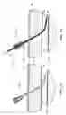 Fig. 04 - Drug eluting vascular closure devices and methods